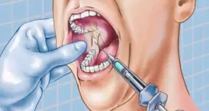 anestezia omnia dental