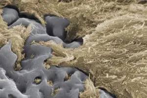 Cum se vede osteointegrarea la microscop