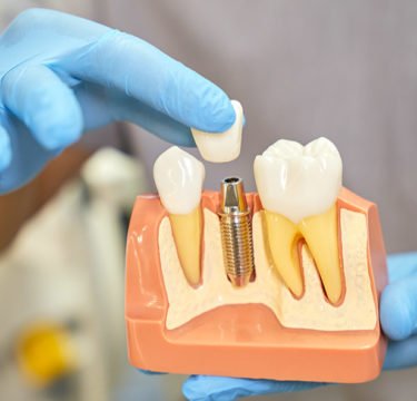 Omnia Dental - Clinică stomatologică București
